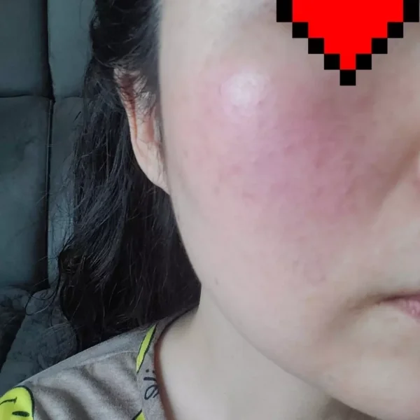 갱년기 트러블 진정 재구매 포토리뷰